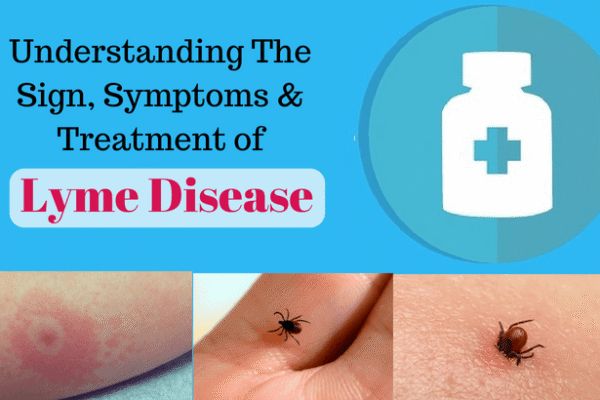 Lyme Disease: Symptoms, Diagnosis and Prevention. Lyme Disease: Symptoms, Diagnosis and Prevention.