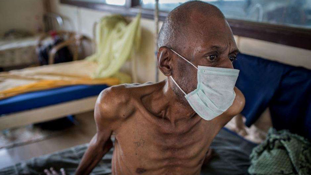 Global TB Report 2025 shows tuberculosis still kills over 1.2 million people annually