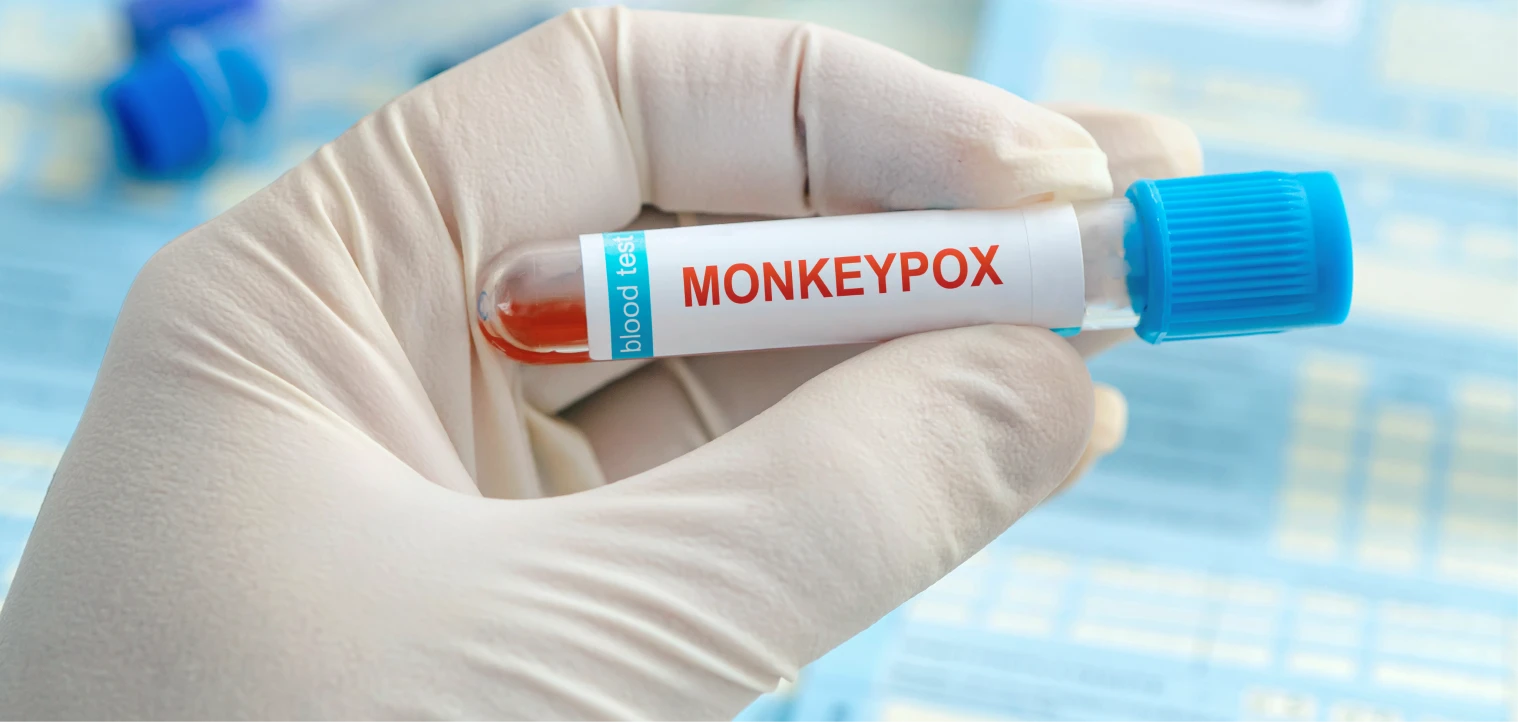 WHO mpox clade Ib global spread