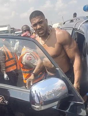 Anthony Joshua to Spend New Year’s Eve at Duchess Luxury Hospital