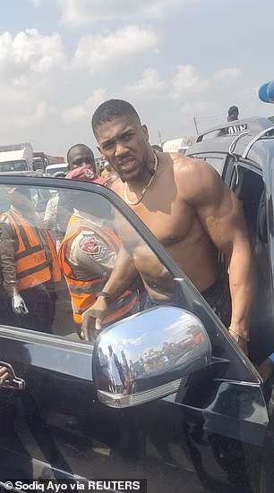 Anthony Joshua to Spend New Year’s Eve at Duchess Luxury Hospital