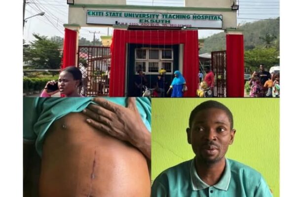 EKSUTH Sacks Doctor After Patient Reports Kidney Removal Without Consent