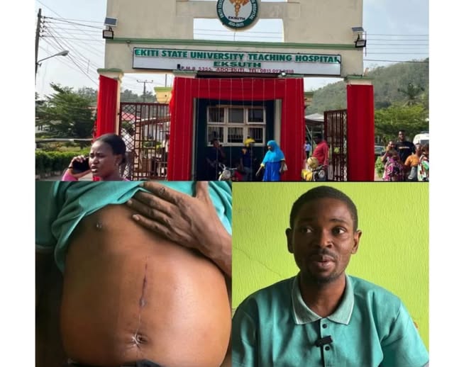 EKSUTH Sacks Doctor After Patient Reports Kidney Removal Without Consent