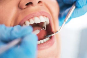 Nigerian Dental Association Warns of Oral Health Crisis
