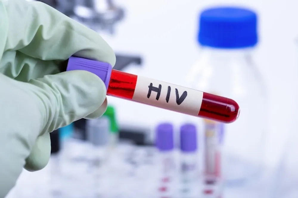 Nigeria, 61 countries face HIV prevention funding cuts